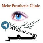 مركز تخصصي پروتز چشم مهر انجام انواع پروتزهای اربیتال چشمی،پروتز اسکلرال شل ،ساخت کامفورمر و اسفربال