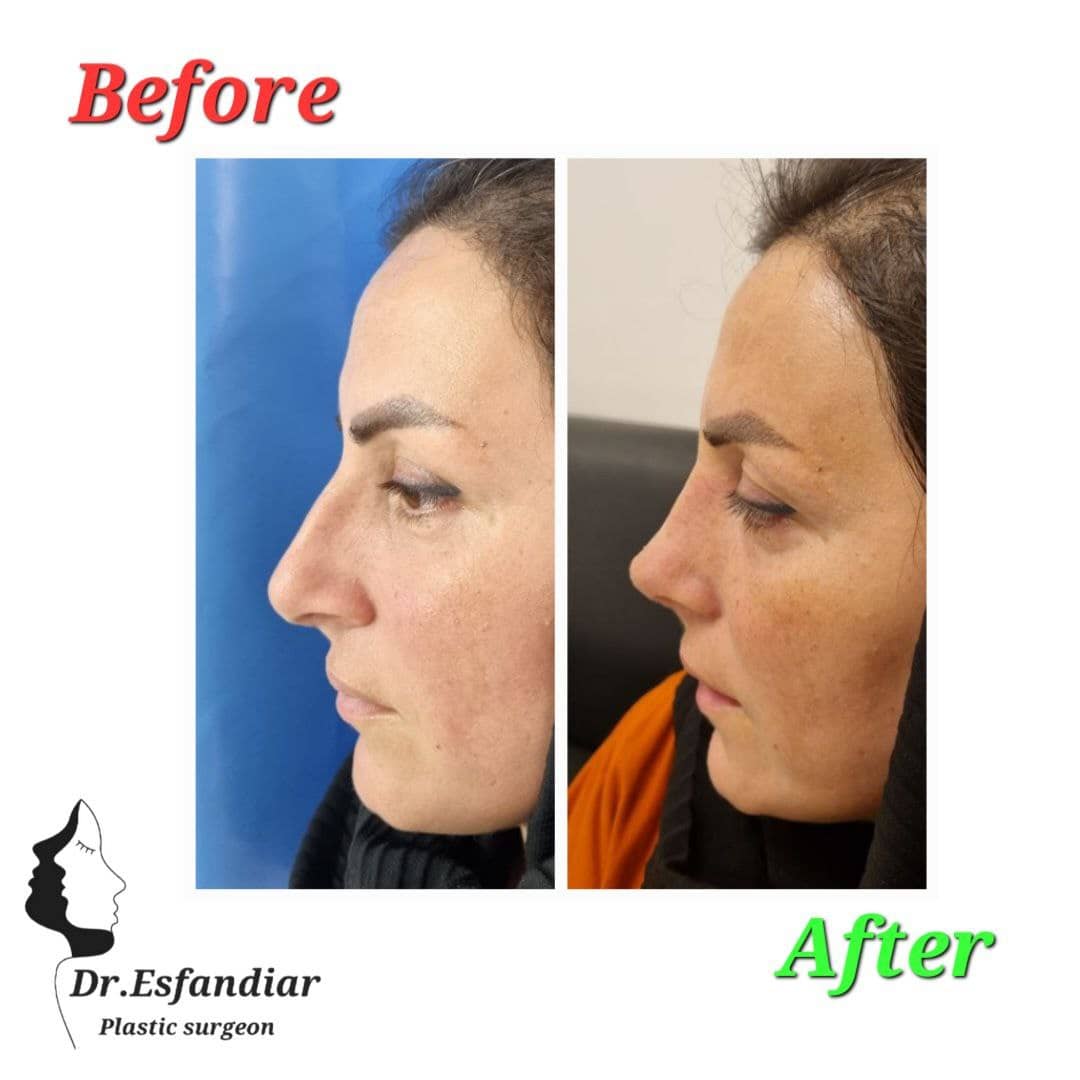 دکتر علی اصغر اسفندیار فوق تخصص جراحی زیبائی ترمیمی عمل زیبایی بینی جراحی زیبایی جراحی پلک بالا جراحی بینی استخوانی جراحی بینی گوشتی