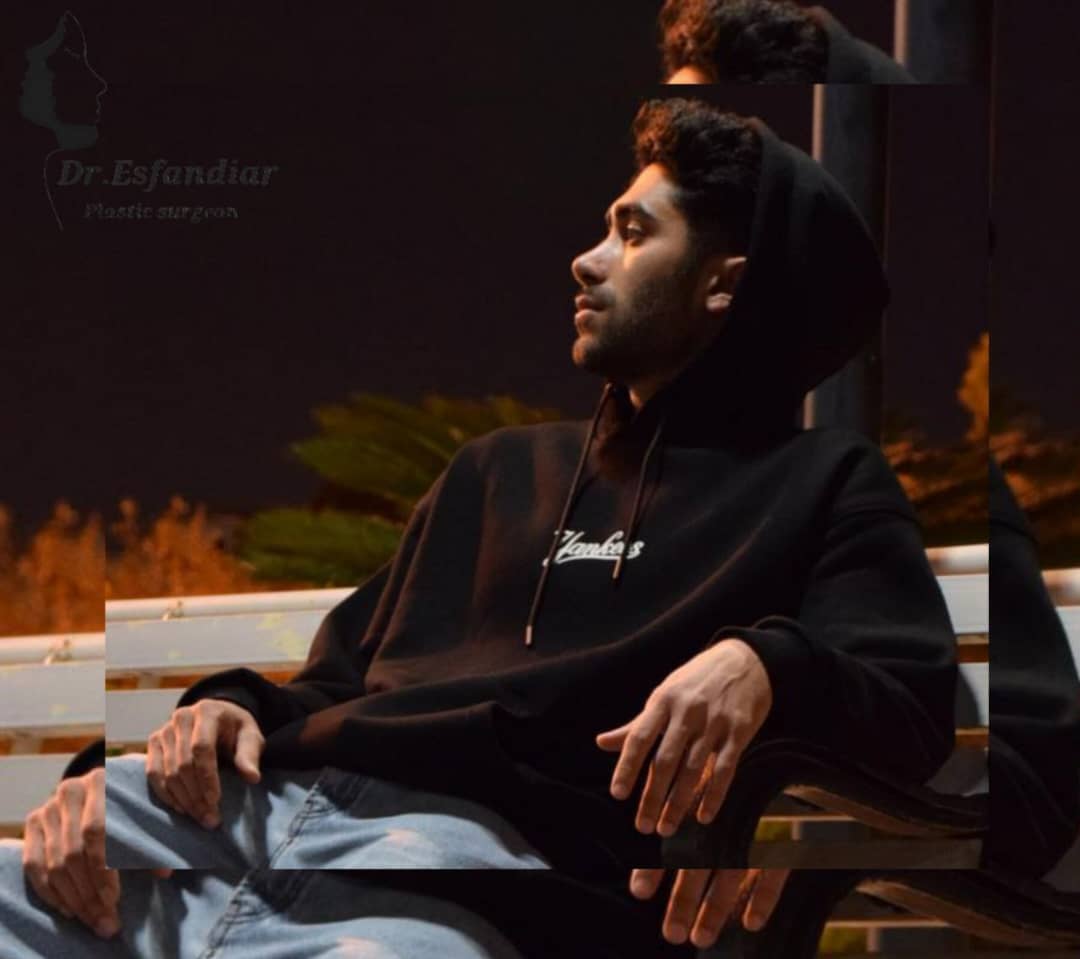 دکتر علی اصغر اسفندیار فوق تخصص جراحی زیبائی ترمیمی عمل زیبایی بینی جراحی زیبایی جراحی پلک بالا جراحی بینی استخوانی جراحی بینی گوشتی