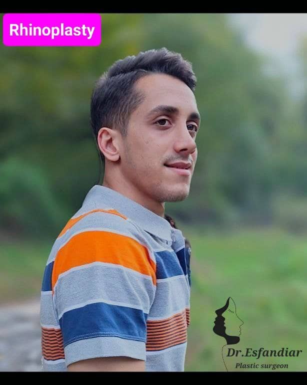 دکتر علی اصغر اسفندیار، فوق تخصص جراحی زیبائی و ترمیمی جراحی بینی جراحی پلک جراحی پستان جراحی شکم فوق تخصص جراحى زيبايى پلاستيك ساری